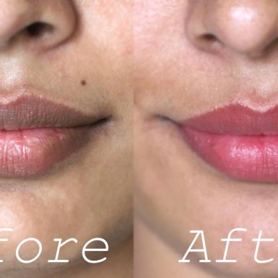 How to Lighten My Dark Lips?
