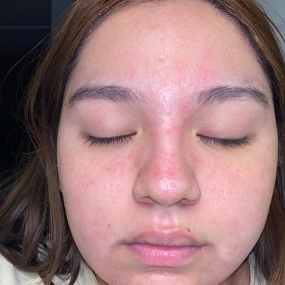 Can You Be Allergic to Makeup Brushes?