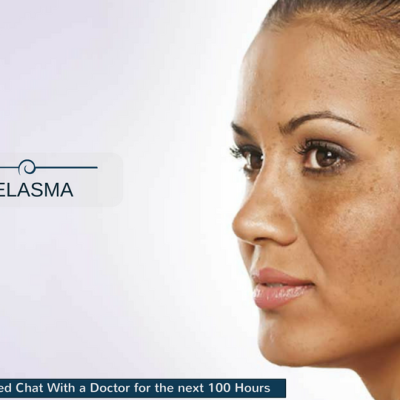 Does Melasma Spread?