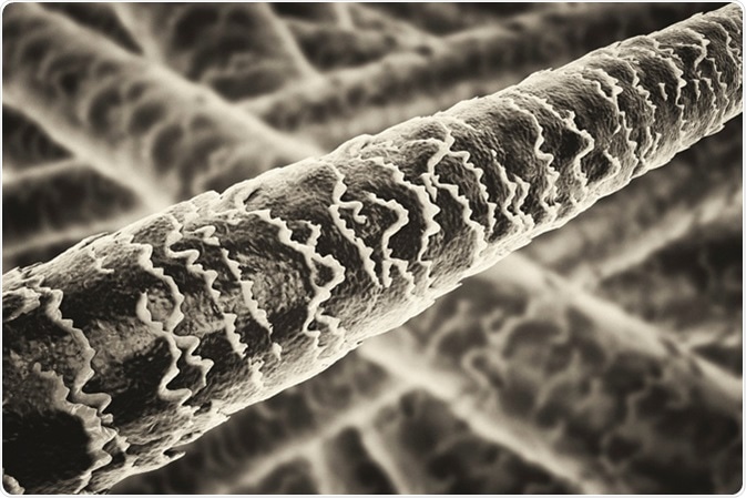 What is Hair Microscopy?