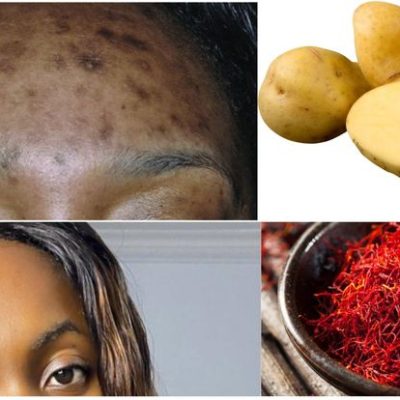 Which Juice Reduces Pigmentation?