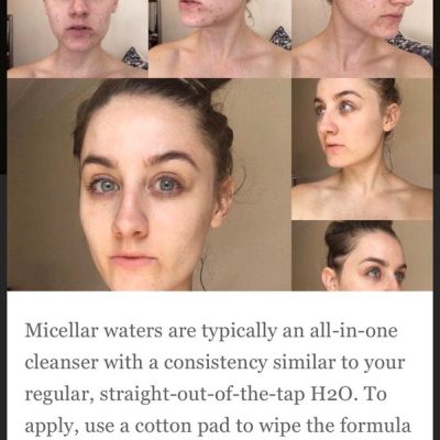 Do You Need to Wash Your Face After Using a Makeup Remover